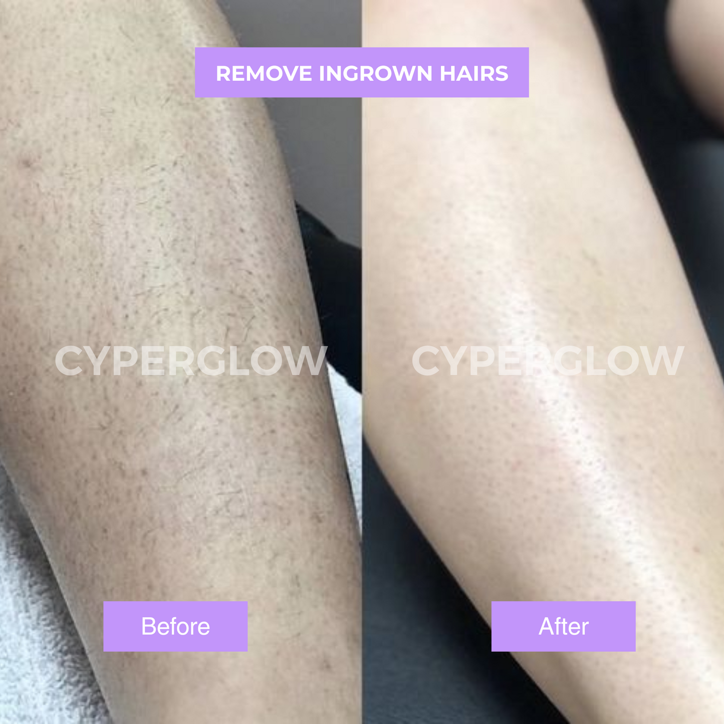 Ruvall™ - Cyperus Rotundus Skin Serum