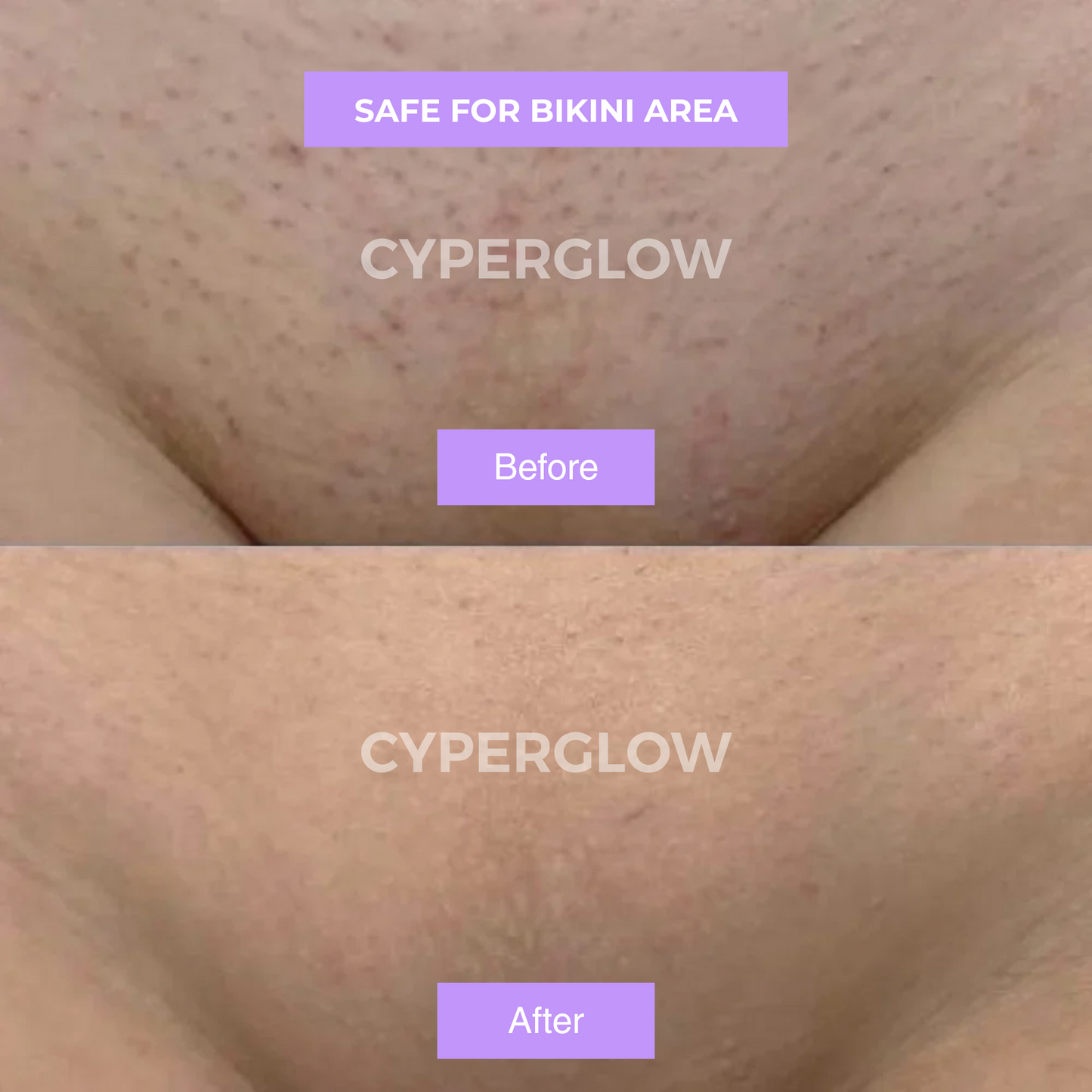 Ruvall™ - Cyperus Rotundus Skin Serum