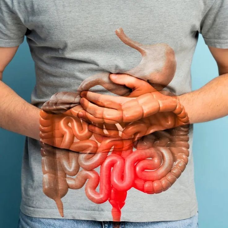 RUVALL™ - GUT SUPPORT CAPSULE