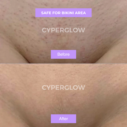 Ruvall™ - Cyperus Rotundus Skin Serum